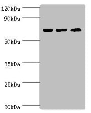 Western blot All lanes: PIAS2 antibody at 2µg/ml Lane 1: A431 whole cell lysate Lane 2: HepG2 whole cell lysate Lane 3: Mouse brain tissue Secondary Goat polyclonal to rabbit IgG at 1/10000 dilution Predicted band size: 69, 64, 46 kDa Observed ban...