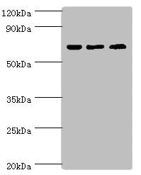 Western blot All lanes: PIAS2 antibody at 2µg/ml Lane 1: A431 whole cell lysate Lane 2: HepG2 whole cell lysate Lane 3: Mouse brain tissue Secondary Goat polyclonal to rabbit IgG at 1/10000 dilution Predicted band size: 69, 64, 46 kDa Observed ban...