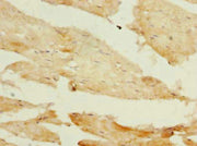 Immunohistochemistry of paraffin-embedded human skeletal muscle tissue using CSB-PA018003LA01HU at dilution of 1:100