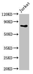 Western Blot Positive WB detected in: Jurkat whole cell lysate All lanes: PIK3R2 antibody at 4ug/ml Secondary Goat polyclonal to rabbit IgG at 1/50000 dilution Predicted band size: 82 kDa Observed band size: 82 kDa