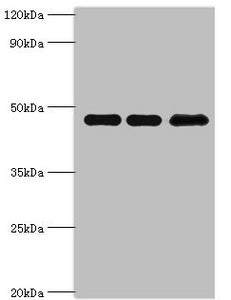 Western blot All lanes: Phosphatidylinositol 5-phosphate 4-kinase type-2 beta antibody at 10ug/ml Lane 1: Hela whole cell lysate Lane 2: MCF-7 whole cell lysate Lane 3: 293T whole cell lysate Secondary Goat polyclonal to rabbit IgG at 1/10000 dilu...