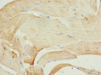 Immunohistochemistry of paraffin-embedded human skeletal muscle tissue using CSB-PA018026ESR1HU at dilution of 1:100