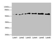 Western blot All lanes: PIP5K1B antibody at 5.46ug/ml Lane 1: Human placenta tissue Lane 2: Mouse kidney tissue Lane 3: Mouse skeletal muscle tissue Lane 4: Mouse heart tissue Lane 5: Mouse brain tissue Lane 6: Mouse lung tissue Secondary Goat pol...