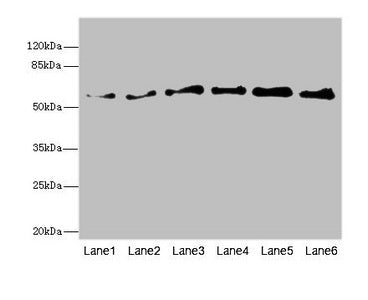 Western blot All lanes: PIP5K1B antibody at 5.46ug/ml Lane 1: Human placenta tissue Lane 2: Mouse kidney tissue Lane 3: Mouse skeletal muscle tissue Lane 4: Mouse heart tissue Lane 5: Mouse brain tissue Lane 6: Mouse lung tissue Secondary Goat pol...