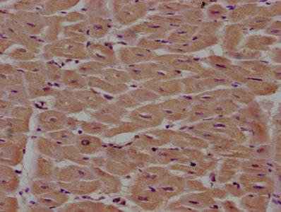 IHC image of CSB-PA018035LA01HU diluted at 1:100 and staining in paraffin-embedded human heart tissue performed on a Leica BondTM system. After dewaxing and hydration, antigen retrieval was mediated by high pressure in a citrate buffer (pH 6.0). S...