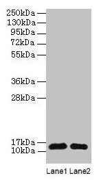 Western blot All lanes: RPL36AL antibody at 2µg/ml Lane 1: EC109 whole cell lysate Lane 2: 293T whole cell lysate Secondary Goat polyclonal to rabbit IgG at 1/15000 dilution Predicted band size: 13 kDa Observed band size: 13 kDa