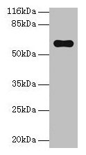 Western blot All lanes: Pklr antibody at 2µg/ml + Hela whole cell lysate Secondary Goat polyclonal to rabbit IgG at 1/10000 dilution Predicted band size: 63, 59 kDa Observed band size: 63 kDa