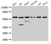 Western Blot Positive WB detected in: Hela whole cell lysate, 293 whole cell lysate, HepG2 whole cell lysate, NIH/3T3 whole cell lysate, LO2 whole cell lysate, Mouse brain tissue All lanes: PKM antibody at 4.5µg/ml Secondary Goat polyclonal to rab...