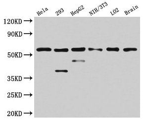 Western Blot Positive WB detected in: Hela whole cell lysate, 293 whole cell lysate, HepG2 whole cell lysate, NIH/3T3 whole cell lysate, LO2 whole cell lysate, Mouse brain tissue All lanes: PKM antibody at 4.5µg/ml Secondary Goat polyclonal to rab...