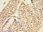 Immunohistochemistry of paraffin-embedded human small intestine tissue using CSB-PA018089LA01HU at dilution of 1:100