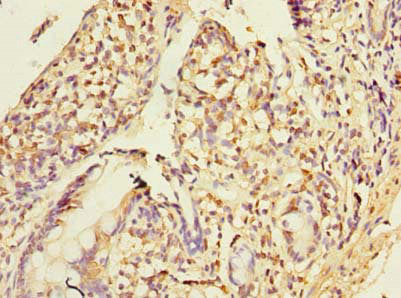 Immunohistochemistry of paraffin-embedded human small intestine tissue using CSB-PA018089LA01HU at dilution of 1:100