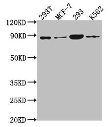 Western Blot Positive WB detected in: 293T whole cell lysate, MCF-7 whole cell lysate, 293 whole cell lysate, K562 whole cell lysate All lanes: P0C869 antibody at 1:2000 Secondary Goat polyclonal to rabbit IgG at 1/50000 dilution Predicted band si...