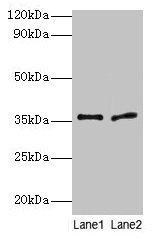 Western blot All lanes: Plaur antibody at 2µg/ml Lane 1: 293T whole cell lysate Lane 2: Rat brain tissue Secondary Goat polyclonal to rabbit IgG at 1/10000 dilution Predicted band size: 36, 25 kDa Observed band size: 36 kDa