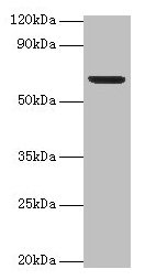 Western blot All lanes: Plbd2 antibody at 2µg/ml + Mouse brain tissue Secondary Goat polyclonal to rabbit IgG at 1/15000 dilution Predicted band size: 67, 50 kDa Observed band size: 67 kDa