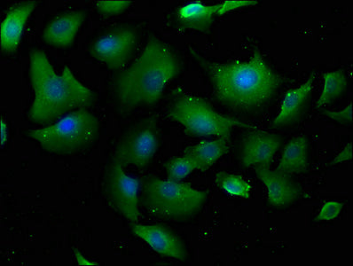 Immunofluorescence staining of U251 cells with CSB-PA018134LA01HU at 1:100, counter-stained with DAPI. The cells were fixed in 4% formaldehyde, permeabilized using 0.2% Triton X-100 and blocked in 10% normal Goat Serum. The cells were then incubat...