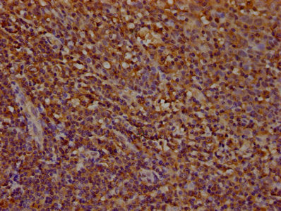 IHC image of CSB-PA018135LA01HU diluted at 1:100 and staining in paraffin-embedded human tonsil tissue performed on a Leica BondTM system. After dewaxing and hydration, antigen retrieval was mediated by high pressure in a citrate buffer (pH 6.0)....