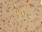Immunohistochemistry of paraffin-embedded human brain tissue using CSB-PA018146LA01HU at dilution of 1:100