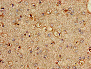 Immunohistochemistry of paraffin-embedded human brain tissue using CSB-PA018146LA01HU at dilution of 1:100