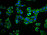 Immunofluorescence staining of PC-3 cells with CSB-PA018174LA01HU at 1:66, counter-stained with DAPI. The cells were fixed in 4% formaldehyde, permeabilized using 0.2% Triton X-100 and blocked in 10% normal Goat Serum. The cells were then incubate...