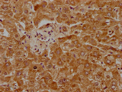 IHC image of CSB-PA018188LA01HU diluted at 1:1000 and staining in paraffin-embedded human liver tissue performed on a Leica BondTM system. After dewaxing and hydration, antigen retrieval was mediated by high pressure in a citrate buffer (pH 6.0)....