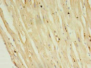 Immunohistochemistry of paraffin-embedded human heart tissue using CSB-PA018198LA01HU at dilution of 1:100