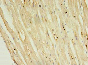 Immunohistochemistry of paraffin-embedded human heart tissue using CSB-PA018198LA01HU at dilution of 1:100