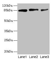 Western Blot All lanes: PLOD2 antibody at 12µg/ml Lane 1: U87 whole cell lysate Lane 2: U251 whole cell lysate Lane 3: 293T whole cell lysate Secondary Goat polyclonal to rabbit IgG at 1/10000 dilution Predicted band size: 85, 88, 50 kDa Observed...