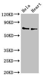 Western Blot Positive WB detected in: Hela whole cell lysate, Mouse heart tissue All lanes: PLS3 antibody at 3.4µg/ml Secondary Goat polyclonal to rabbit IgG at 1/50000 dilution Predicted band size: 71, 70, 66 kDa Observed band size: 71 kDa