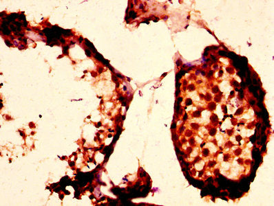 IHC image of CSB-PA018212EA01HU diluted at 1:200 and staining in paraffin-embedded human testis tissue performed on a Leica BondTM system. After dewaxing and hydration, antigen retrieval was mediated by high pressure in a citrate buffer (pH 6.0)....
