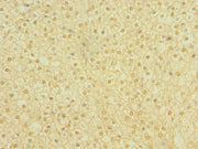 Immunohistochemistry of paraffin-embedded human adrenal gland tissue using CSB-PA018218ESR2HU at dilution of 1:100