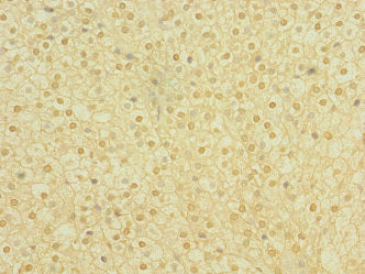 Immunohistochemistry of paraffin-embedded human adrenal gland tissue using CSB-PA018218ESR2HU at dilution of 1:100