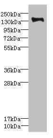 Western blot All lanes: PLXNB2 antibody IgG at 2.39ug/ml + Mouse liver tissue Secondary Goat polyclonal to rabbit IgG at 1/10000 dilution Predicted band size: 205 kDa Observed band size: 205 kDa