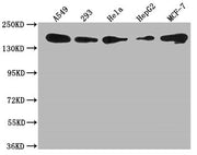 Western Blot Positive WB detected in: A549 whole cell lysate, 293 whole cell lysate, Hela whole cell lysate, HepG2 whole cell lysate, MCF-7 whole cell lysate All lanes: PLXNB2 antibody at 1:1000 Secondary Goat polyclonal to rabbit IgG at 1/50000 d...