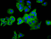 Immunofluorescence staining of HepG2 cells with CSB-PA018225LA01HU at 1:33, counter-stained with DAPI. The cells were fixed in 4% formaldehyde, permeabilized using 0.2% Triton X-100 and blocked in 10% normal Goat Serum. The cells were then incubat...