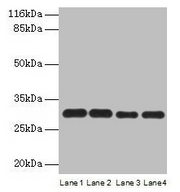 Western blot All lanes: PMM1 antibody at 2µg/ml Lane 1: HepG2 whole cell lysate Lane 2: NIH/3T3 whole cell lysate Lane 3: 293T whole cell lysate Lane 4: Mouse brain tissue Secondary Goat polyclonal to rabbit IgG at 1/10000 dilution Predicted band...