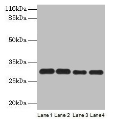 Western blot All lanes: PMM1 antibody at 2µg/ml Lane 1: HepG2 whole cell lysate Lane 2: NIH/3T3 whole cell lysate Lane 3: 293T whole cell lysate Lane 4: Mouse brain tissue Secondary Goat polyclonal to rabbit IgG at 1/10000 dilution Predicted band...