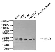 Western Blot Positive WB detected in: A549 whole cell lysate(20µg), MCF7 whole cell lysate(20µg), Hela whole cell lysate(20µg), HEK293T whole cell lysate(20µg), Mouse kidney tissue lysate(20µg) All lanes: PMM2 antibody at 1:500 Secondary Goat poly...