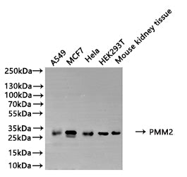 Western Blot Positive WB detected in: A549 whole cell lysate(20µg), MCF7 whole cell lysate(20µg), Hela whole cell lysate(20µg), HEK293T whole cell lysate(20µg), Mouse kidney tissue lysate(20µg) All lanes: PMM2 antibody at 1:500 Secondary Goat poly...