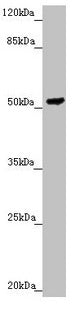 Western blot All lanes: PMPCB antibody at 2.3µg/ml + HepG2 whole cell lysate Secondary Goat polyclonal to rabbit IgG at 1/10000 dilution Predicted band size: 55 kDa Observed band size: 55 kDa