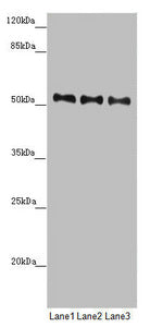 Western blot All lanes: PMPCB antibody at 0.69 ug/ml Lane 1: Mouse heart tissue Lane 2: Mouse kidney tissue Lane 3: Mouse liver tissue Secondary Goat polyclonal to rabbit IgG at 1/10000 dilution Predicted band size: 54 kDa Observed band size: 54 kDa