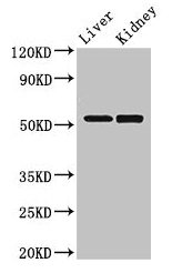 Western Blot Positive WB detected in: Mouse liver tissue, Mouse kidney tissue All lanes: PNLIPRP3 antibody at 3.5µg/ml Secondary Goat polyclonal to rabbit IgG at 1/50000 dilution Predicted band size: 53 kDa Observed band size: 53 kDa
