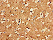 Immunohistochemistry of paraffin-embedded human brain tissue using CSB-PA018267LA01HU at dilution of 1:100