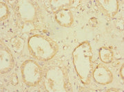 Immunohistochemistry of paraffin-embedded human kidney tissue using CSB-PA018298LA01HU at dilution of 1:100