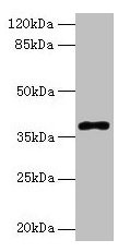Western blot All lanes: POLB antibody at 8µg/ml + Colo320 whole cell lysate Secondary Goat polyclonal to rabbit IgG at 1/10000 dilution Predicted band size: 39 kDa Observed band size: 39 kDa