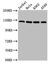Western Blot Positive WB detected in: Jurkat whole cell lysate, Hela whole cell lysate, K562 whole cell lysate, A549 whole cell lysate All lanes: POLD1 antibody at 5µg/ml Secondary Goat polyclonal to rabbit IgG at 1/50000 dilution Predicted band s...
