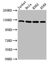 Western Blot Positive WB detected in: Jurkat whole cell lysate, Hela whole cell lysate, K562 whole cell lysate, A549 whole cell lysate All lanes: POLD1 antibody at 5µg/ml Secondary Goat polyclonal to rabbit IgG at 1/50000 dilution Predicted band s...