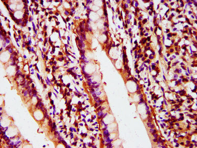 IHC image of CSB-PA018304LA01HU diluted at 1:400 and staining in paraffin-embedded human small intestine tissue performed on a Leica BondTM system. After dewaxing and hydration, antigen retrieval was mediated by high pressure in a citrate buffer (...