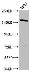 Western Blot Positive WB detected in: 293T whole cell lysate All lanes: POLG antibody at 4.7µg/ml Secondary Goat polyclonal to rabbit IgG at 1/50000 dilution Predicted band size: 140 kDa Observed band size: 140 kDa