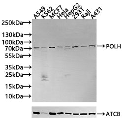 Western Blot Positive WB detected in: A549 whole cell lysate, K562 whole cell lysate All lanes: POLH antibody at 2.8µg/ml Secondary Goat polyclonal to rabbit IgG at 1/50000 dilution Predicted band size: 79, 47 kDa Observed band size: 79 kDa