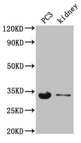Western Blot Positive WB detected in: PC-3 whole cell lysate, Mouse kidney tissue All lanes: POLR2C antibody at 3.5µg/ml Secondary Goat polyclonal to rabbit IgG at 1/50000 dilution Predicted band size: 32 kDa Observed band size: 32 kDa